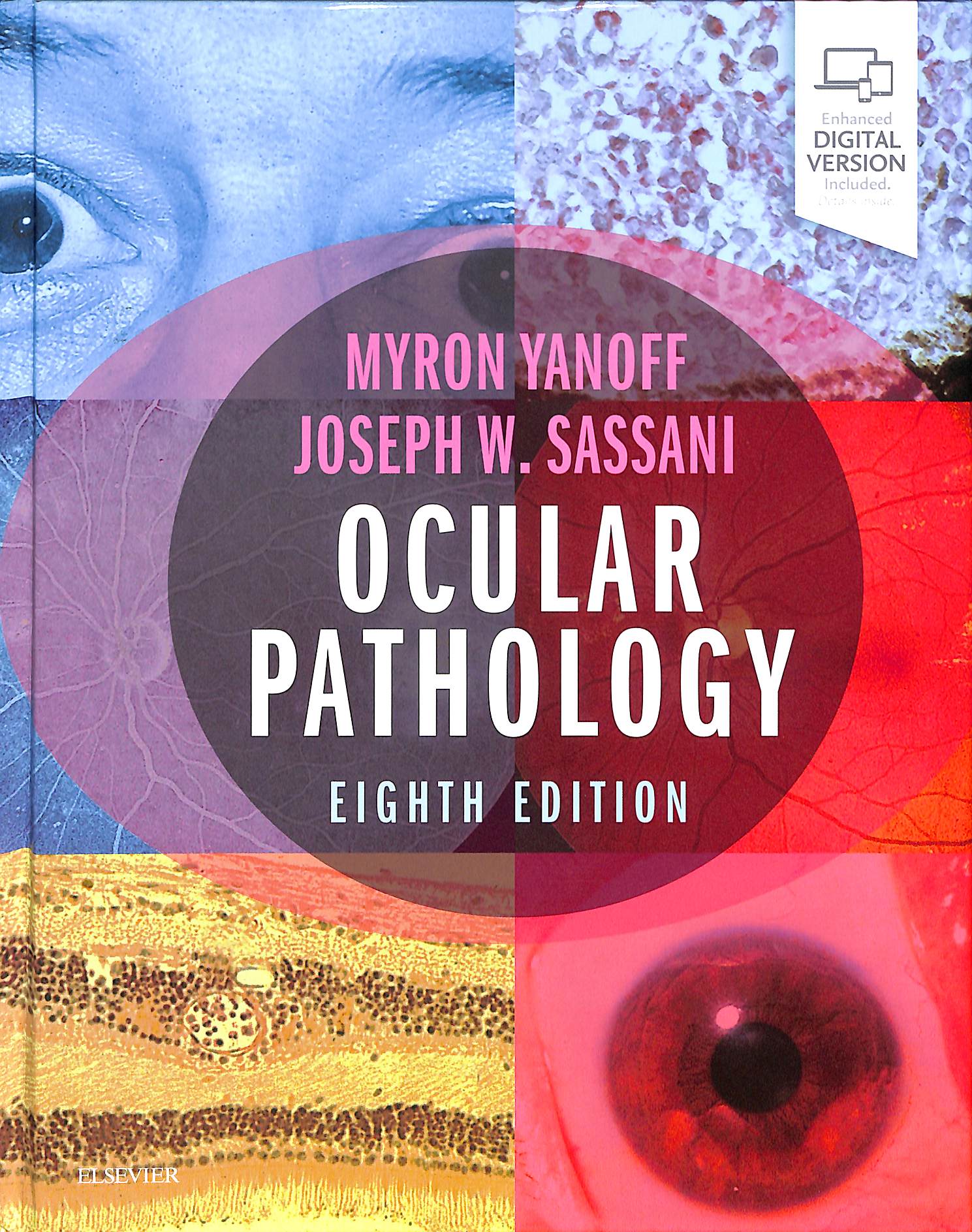 Ocular pathology eighth edition