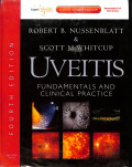 uveitis, fundamentals and clinical practice