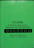 uveitis  a clinical approach to diagnosis and management