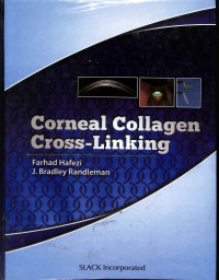 corneal collagen cross linking