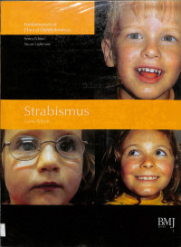 strabismus