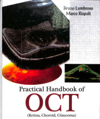 practical handbook of oct (retina,choroid,glaucoma)