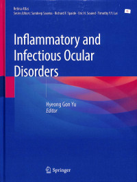 inflammatory and infectious ocular disorders