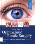 Colour atlas of ophthalmic plastic surgery fourth edition