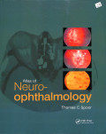 Atlas of Neuro ophthalmology