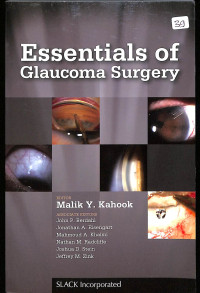 Essentials of glaucoma surgery