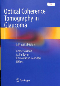 Optical coherence tomography in glaucoma,a practical guide