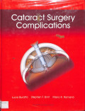 cataract surgery complications