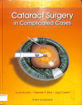 Cataract surgery in complicated cases