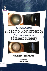 text and atlas slit lamp biomicroscopy for assessment in cataract surgery