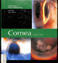 fundamentas of clinical ophthtalmology,cornea