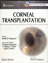 corneal transplantation