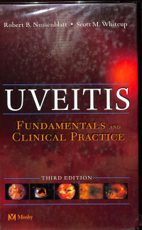 uveitis fundamentals and clinical practice