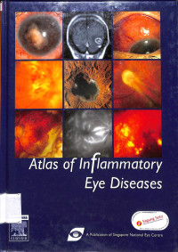 atlas of inflammatory eye disease