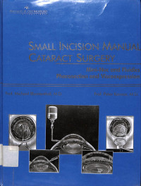 manual small incision cataract surgery training program, manual fo smal incision cataract surgery trainees