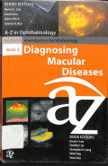 a-z in ophthalmoogy , diagnosing macular diseases