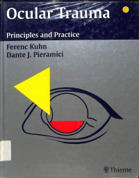 ocular trauma principles and practice