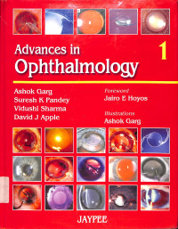 advances in ophthalmology