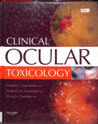 clinical ocular toxicology