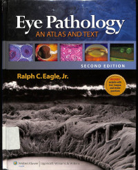 eye pathology an atlas and text