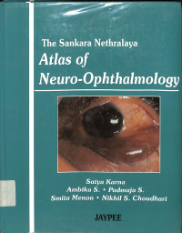 the sankara nethralaya atlas of neuro ophthalmology