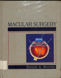 macular surgery