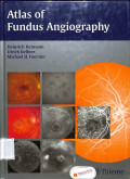 atlas of fundus angiography