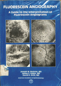 fluorescein angiography , a guide to the interpretation of fluorescein angiograms