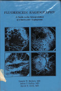 fluorescein angiography, a guide to the interpretation of fluorescein angiograms