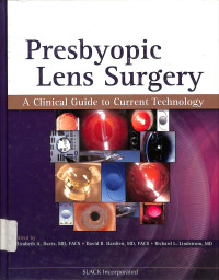 presbyopic lens surgery , a clinical guide to current technology