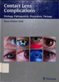 contact lens complications, etiology,pathogenesis,prevention,therapy