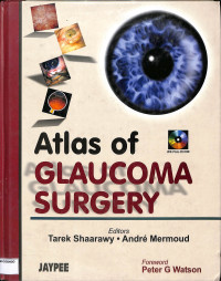 atlas of glaucoma surgery