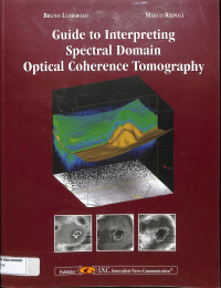 guide to interprenting spectral domain optical coherence tomography