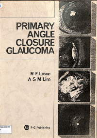 primary angle closure glaucoma