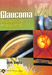 glaucoma diagnosis and management