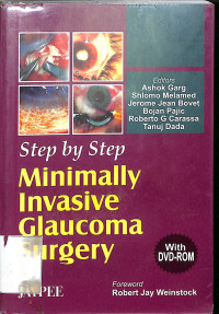 step by step minimally invasive glaucoma surgery