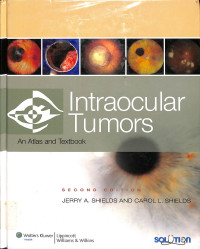 intraocular tumors , an atlas and textbook