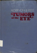 tumors of the eye