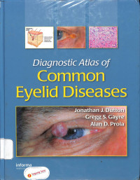 diagnostic atlas of common eyelid diseases