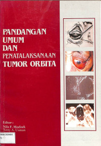 pandangan umum dan penatalaksanaan tumor orbita