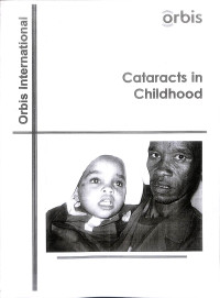 orbis international, cataracts in childhood, orbis international