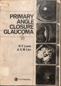 primary angle closure glaucoma