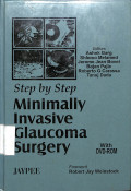 step by step minimally invasive glaucoma surgery