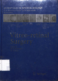 vitrio-retinal surgery