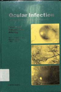 ocular infection , investigation and treatment in practice