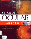 clinical ocular toxicology