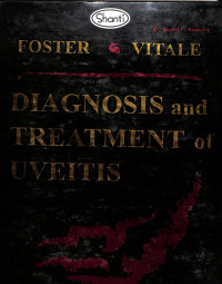 diagnosis and treatment of uveitis