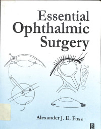 essential ophthalmic surgery