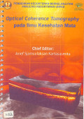 optical coherence tomography pada ilmu kesehatan mata