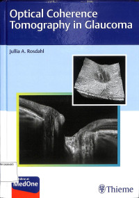 Optical coherence tomography in glaucoma